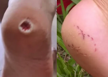 Represa do Broa é interditada após ataques de piranhas em Itirapina